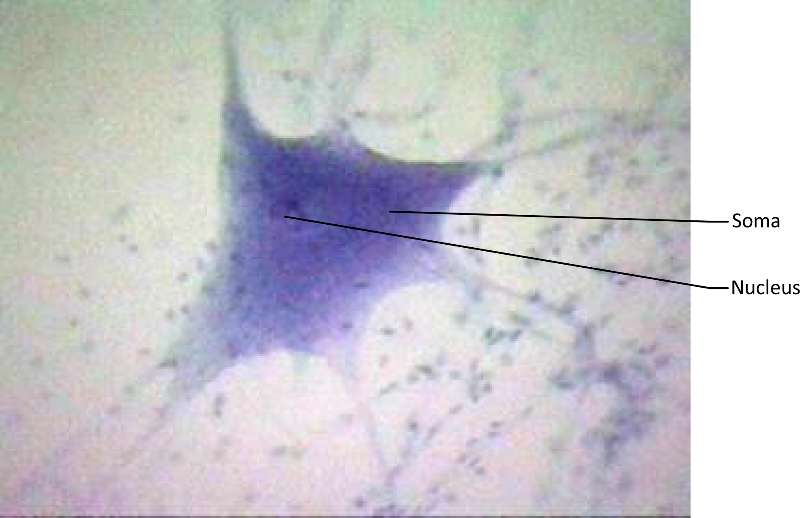 Nervous Tissue micrograph